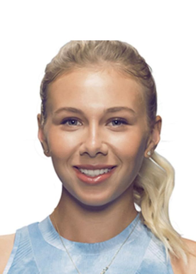 Amanda Anisimova head
